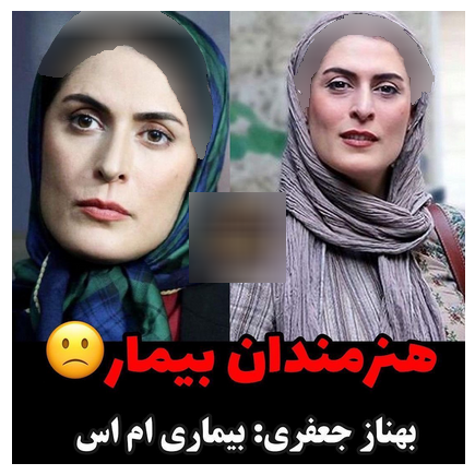 هنرمندانی که بیماری سختی دارند 