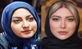 این خانم بازیگران ایران صورت و اندامشان را کوبیدند از نو ساختند + اسامی و عکس های قبل و بعد