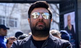 عکس باورنکردنی از محمد علیزاده قبل از کاشت مو ! / اصلا قابل شناسایی نیست !