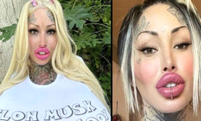 این زن واقعا بیریخت سلطان عمل های زیبایی است ! / خون آشام با لب های پروتزی !