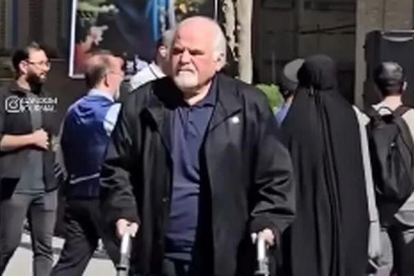 عکس عجیب از تغییر چهره دایی یونسِ محبوب «پس از باران» که همه را غافلگیر کرد!