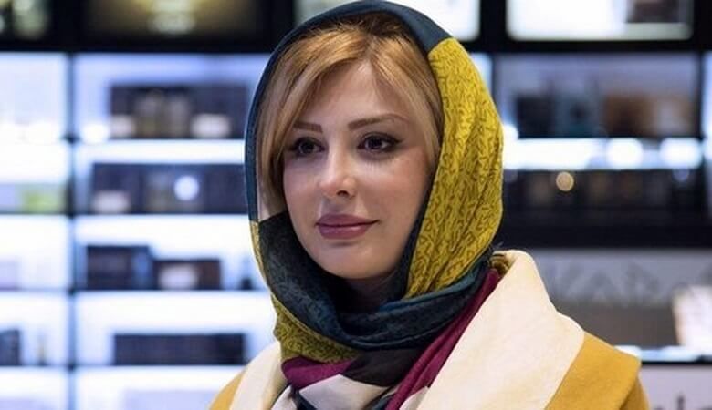 آیا می دانستید این چهره واقعی نیوشا ضیغمی قبل عمل های زیبایی بوده ؟! / وحشت می کنید !