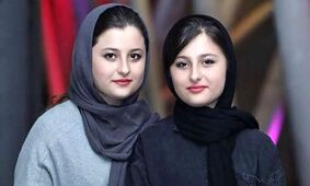 جراحی نیکای محبوب سریال پایتخت: تغییرات شگفت‌انگیز چهره‌اش!