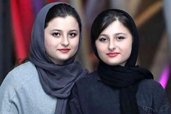 جراحی نیکای محبوب سریال پایتخت: تغییرات شگفت‌انگیز چهره‌اش!