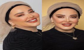 عکس جنجالی از تغییر چهره بهاره رهنما با جدیدترین عمل زیبایی