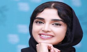 عکس صورت داغون با ابروهای پیوندی الهه حصاری/ این چه وضعشه؟!