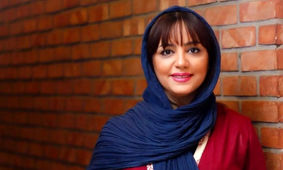  تغییر چهره عروسکی خانم بازیگر سریال خواب و بیدار/ از چهره زشت تا مدلینگی !