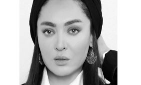  تغییر چهره باورنکردنی نیکی کریمی بعد از یک سال/ این اون نیست ! + عکس ها