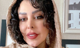 این زن فلور نظری است ؟!  / عمرا خانم بازیگر ابر جراحی زیبایی را بشناسید ! + عکس