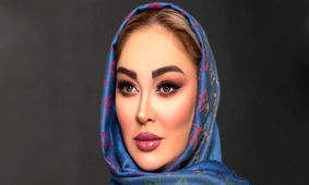 تغییر چهره خیلی متفاوت الهام حمیدی بعد از عمل زیبایی / این اون نیست ! + عکس ها