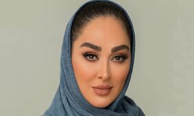 عکس چهره فوق عروسکی الهام حمیدی با جدیدترین عمل زیبایی ! / چه دافی شده !