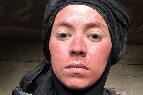 تصاویر شوکه‌کننده از تغییر چهره نیلوفر رجایی‌فر بعد از سریال پایتخت!