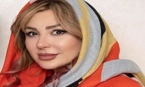 جدیدترین عکس از نیوشا ضیغمی بعد از طلاق / بعد از طلاق دست به دامن تزریق شد !