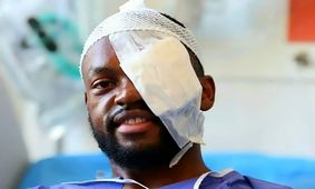  کوین یامگا به عامل مصدمیتش را شرمنده کرد