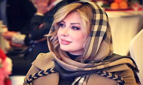 تغییر چهره اساسی نیوشا ضیغمی در گذر زمان + عکس قبل و بعد 