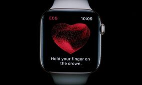 اپل نقض‌کننده پتنت‌های AliveCor شناخته شد؛ فروش اپل واچ در آمریکا ممنوع می‌شود؟
