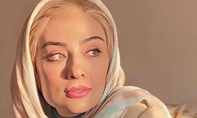 عکس شوکه کننده از تغییر چهره یکتا ناصر / تزریق زیبایی خانم بازیگر را نابود کرد