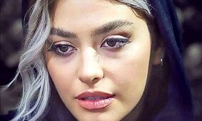 عکس تغییر چهره باورنکردنی ریحانه پارسا 