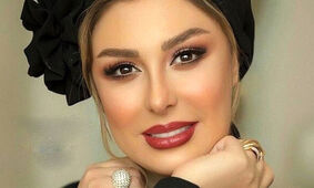  افشاگری جنجالی نیوشا صیغمی از عمل های زیباییش / مجبور شدم + فیلم 