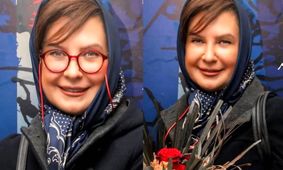 
 اسید پاشی وحشتناک به صورت لعیا زنگنه / چهره خانم بازیگر دیگر قابل شناسایی نیست +عکس 18+