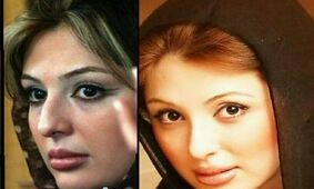 عکس قبل و بعد 7 خانم بازیگر ایرانی بعد از عمل های عروسکی / چه بودند و چه شدند !