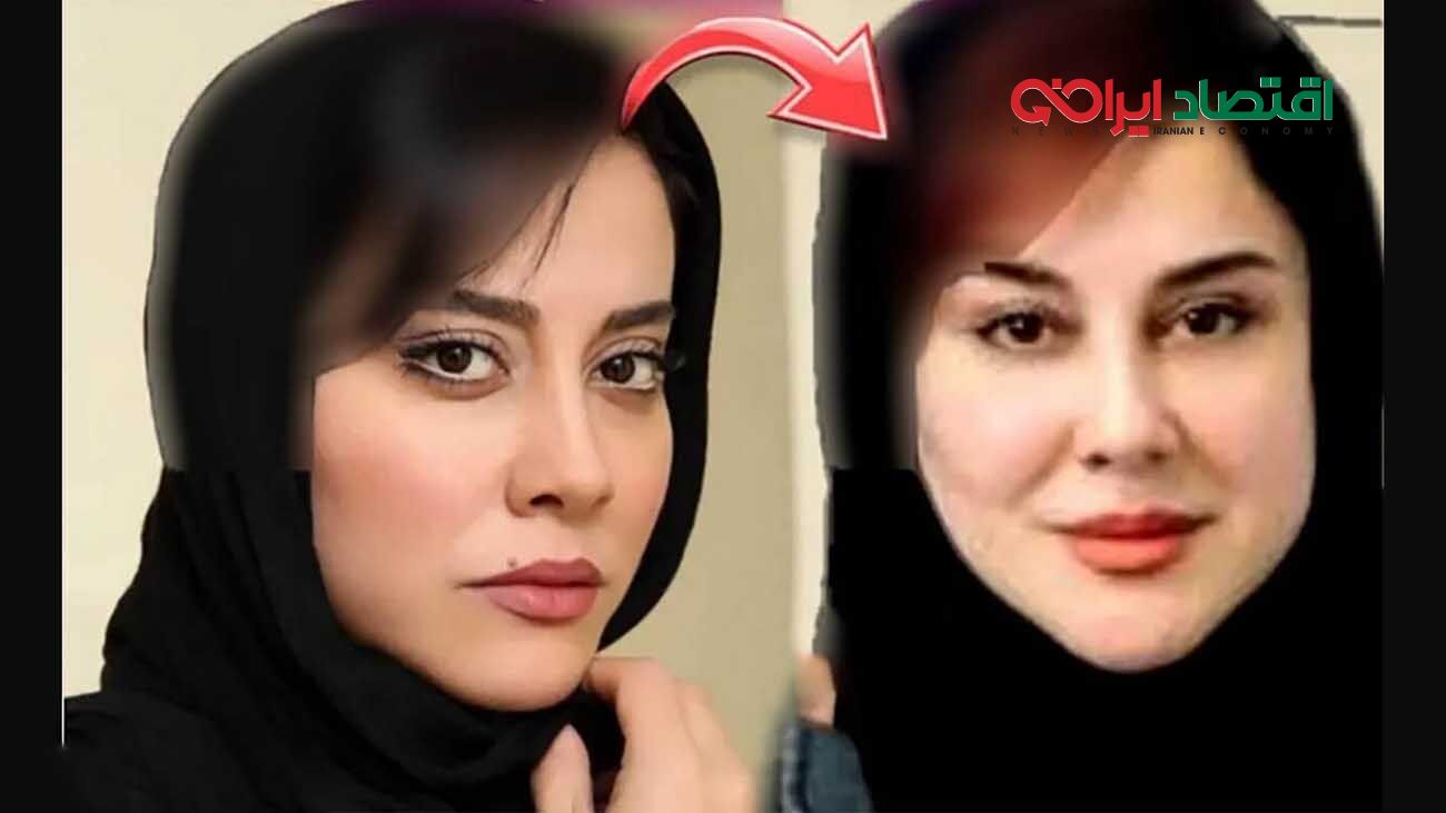 تغییر چهره خیلی زیبا آشا محرابی بعد از تزریقات زیبایی / متفاوت تر از همیشه !