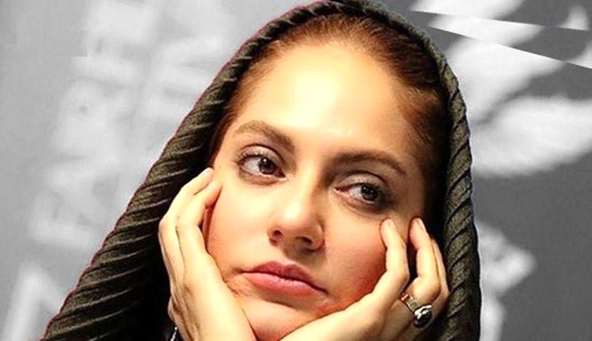 اولین عکس از چهره مهناز افشار قبل از عمل های زیبایی / کاش هیچ وقت آلمان نمی رفت !