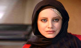 تغییرات فاحش شراره رخام قبل و بعد عمل زیبایی + عکس 